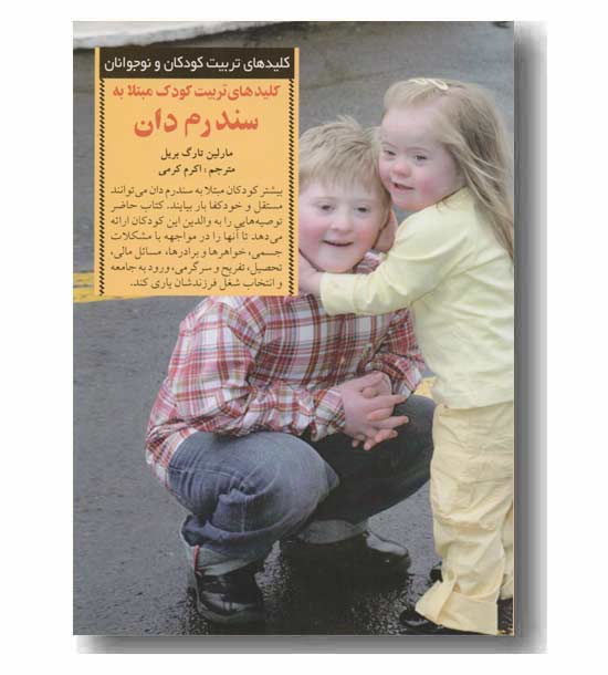 کلیدهای تربیت کودک مبتلا به سندرم دان
